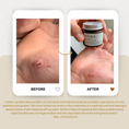 Load image into Gallery viewer, Koaka Skin Rescue Balm Cut Hand
