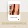 Load image into Gallery viewer, Koaka Skin Rescue Balm Testimonial | Eczema
