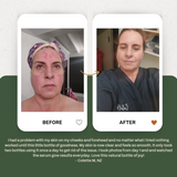 Anti-Redness Facial Oil